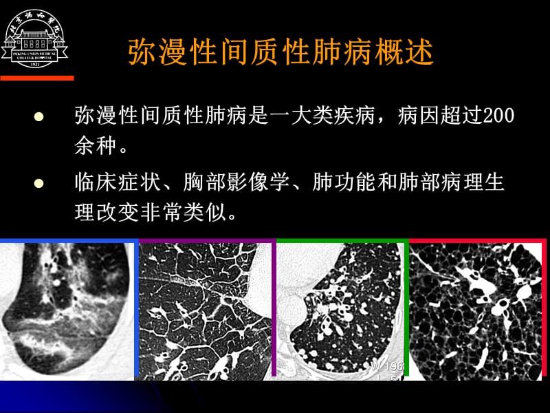 弥漫性间质性肺病诊断思路.ppt_第2页