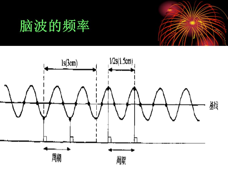 脑电图基本入门PPT课件.ppt_第3页