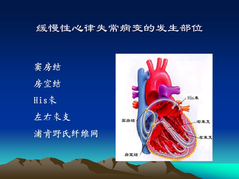 缓慢性心律失常的诊断及治疗 ppt课件.ppt_第3页