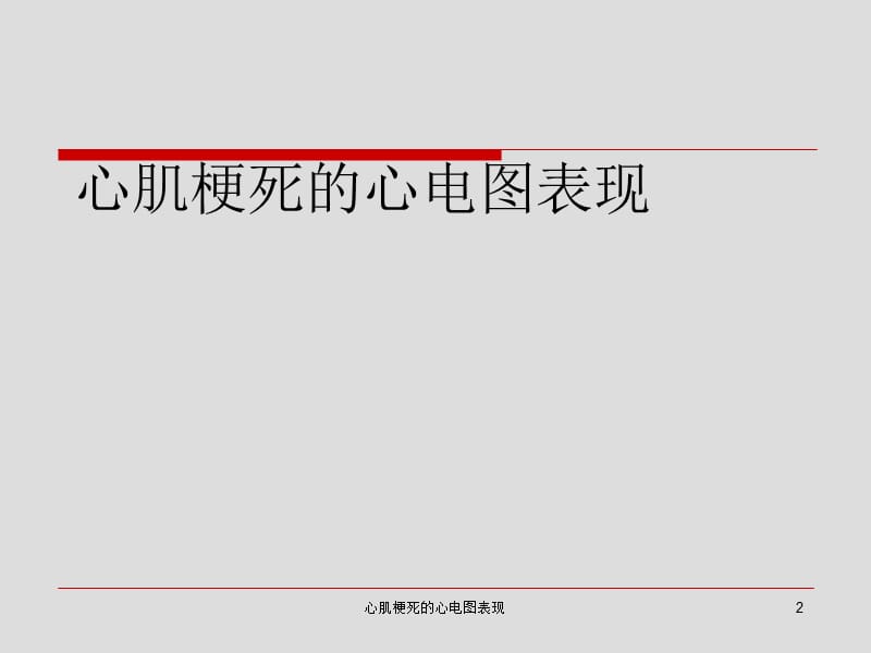 心肌梗死的心电图表现课件.ppt_第2页