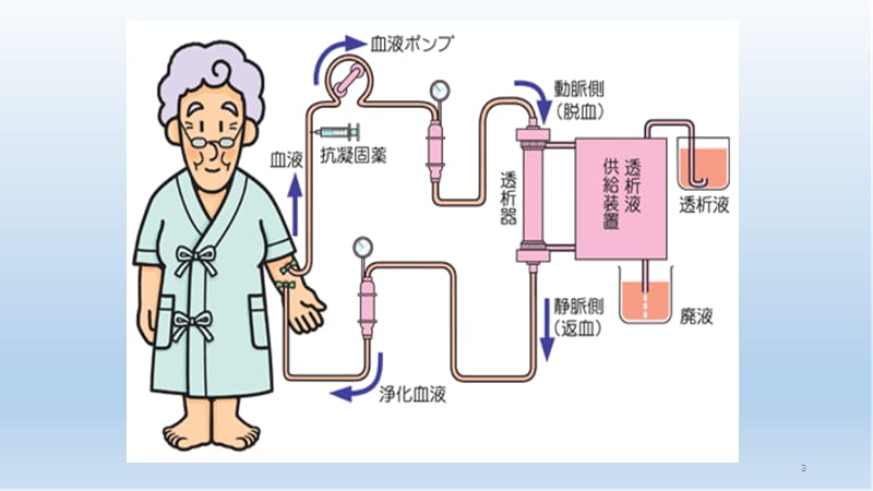 可调钠在血液透析中的应用.pptx_第3页