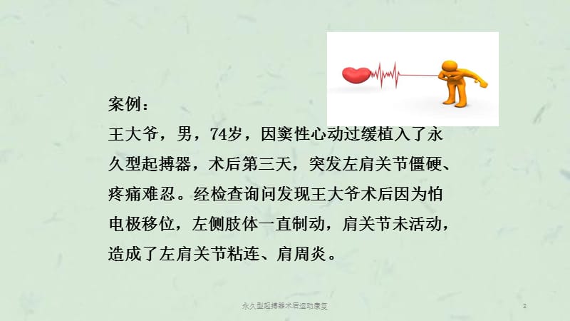 永久型起搏器术后运动康复课件.ppt_第2页