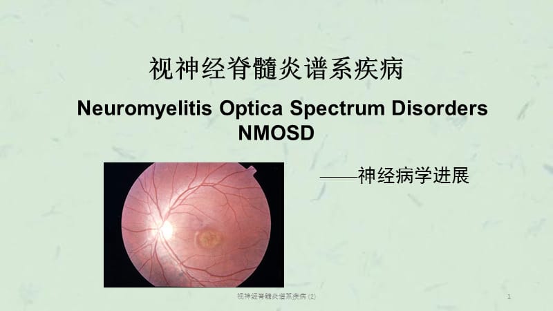 视神经脊髓炎谱系疾病 (2)课件.ppt_第1页