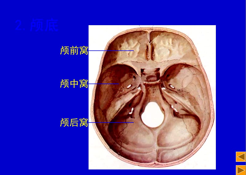 《颅脑断层》PPT课件.ppt_第3页