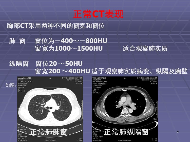 （推荐）正常胸肺部CT.ppt_第2页