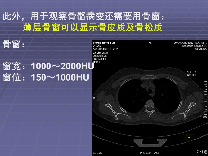 （推荐）正常胸肺部CT.ppt_第3页