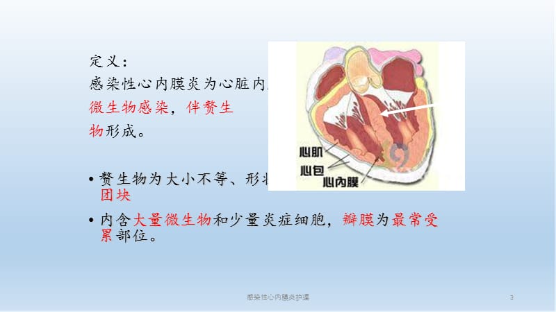 感染性心内膜炎护理.ppt_第3页