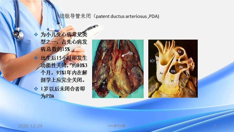 PDA(课件分享).pptx_第2页