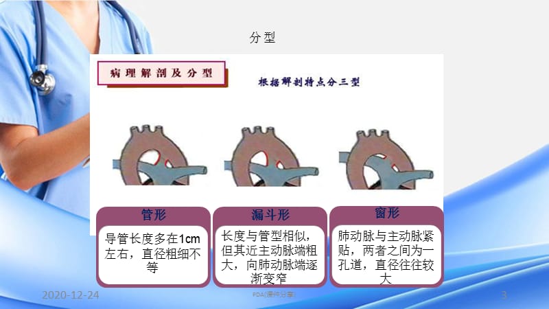 PDA(课件分享).pptx_第3页