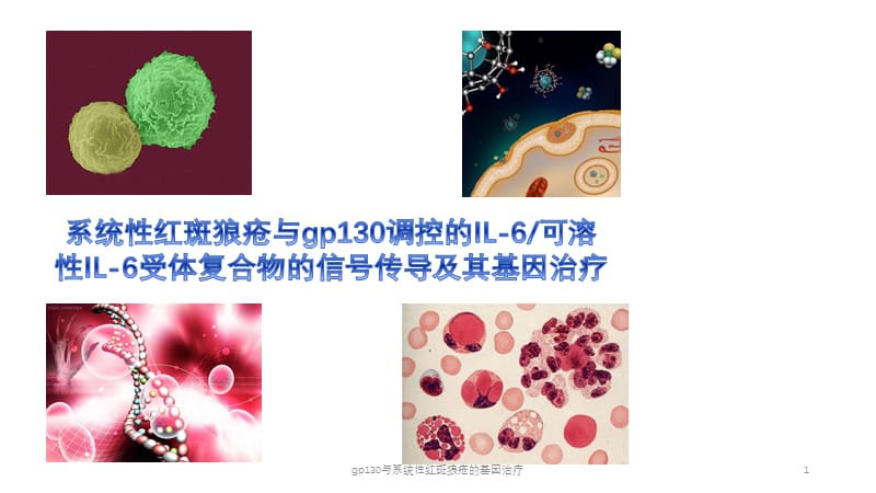 gp130与系统性红斑狼疮的基因治疗课件.pptx_第1页