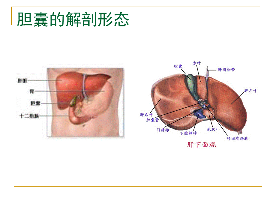 慢性胆囊炎、胆石症.ppt.ppt_第2页