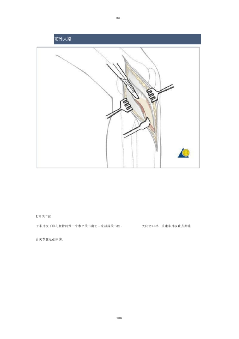 胫骨平台前外侧入路.docx_第3页