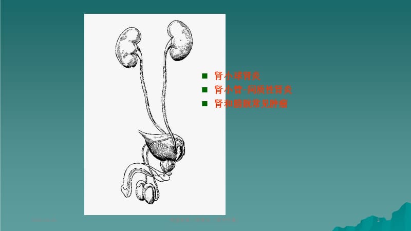 病理学肾小球肾炎（课件分享）.ppt_第2页