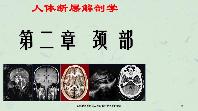 颈部断层解剖第二节颈部横断层解剖最终课件.ppt_第2页