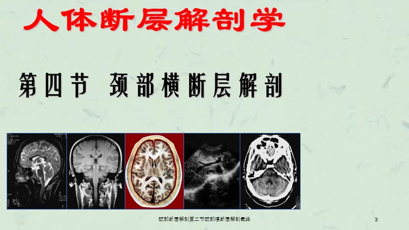 颈部断层解剖第二节颈部横断层解剖最终课件.ppt_第3页