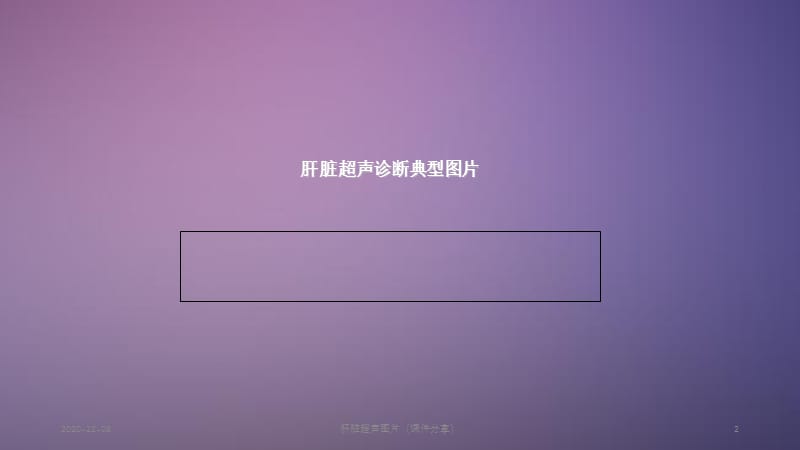 肝脏超声图片（课件分享）.ppt_第2页