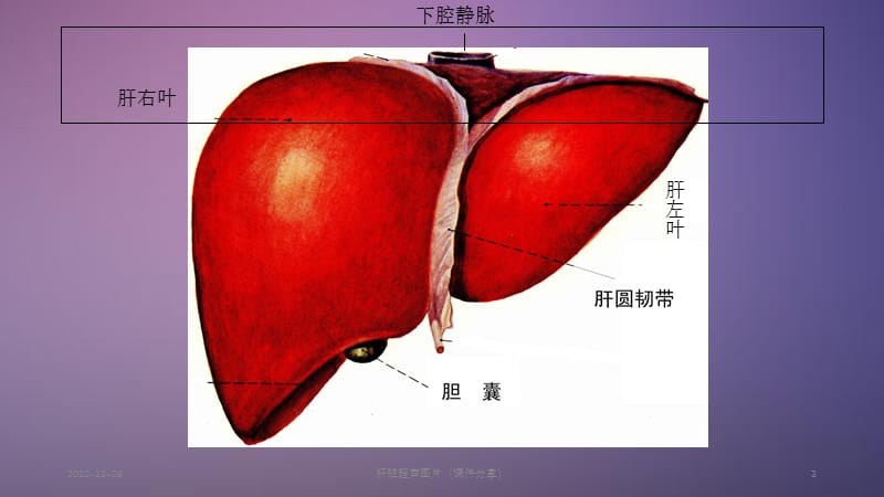 肝脏超声图片（课件分享）.ppt_第3页