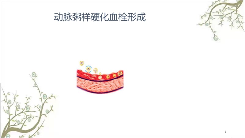 冠心病健康手册课件.ppt_第3页