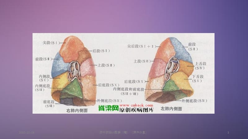 肺叶肺段ct图解（精）（课件分享）.ppt_第3页