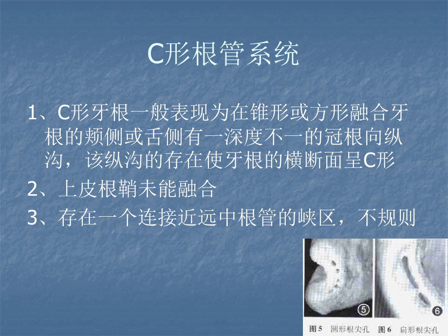 C型根管疗系统的形态和治疗.ppt_第2页