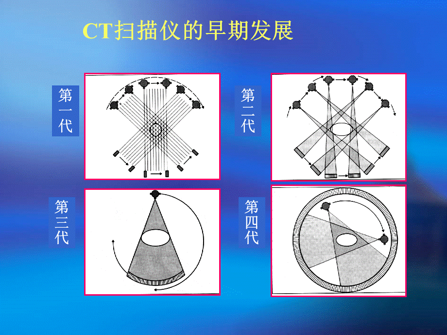 CT基本原理与技术进展.ppt_第3页