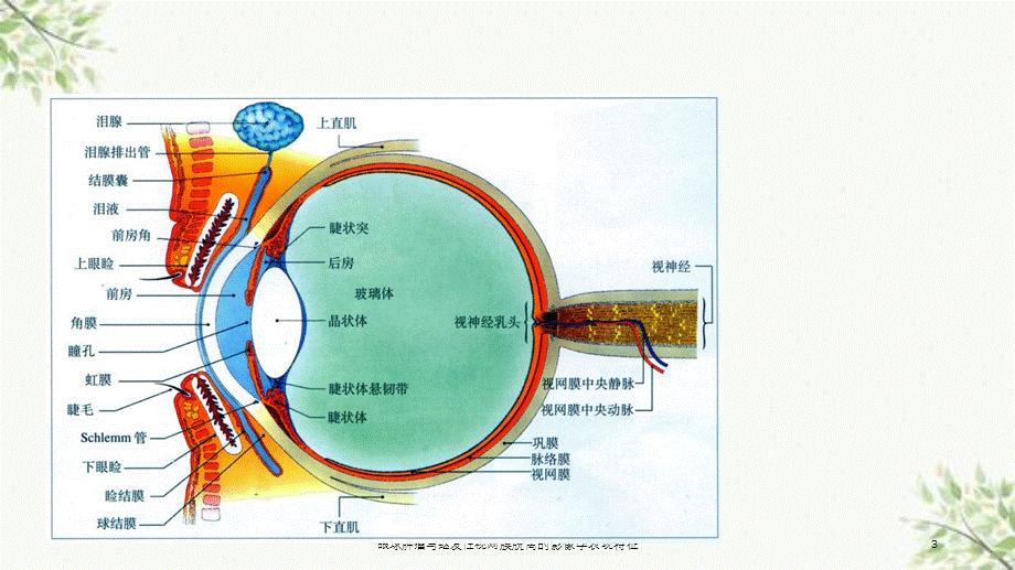 眼球肿瘤与继发性视网膜脱离的影像学表现特征课件.ppt_第3页