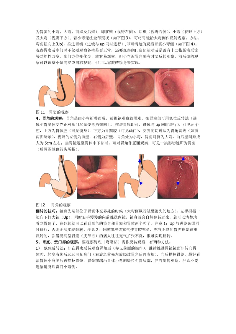 胃镜操作方法.doc_第2页