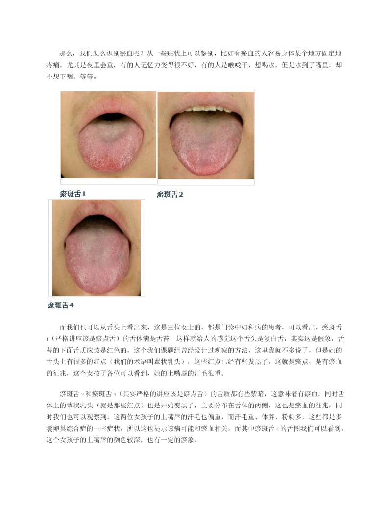 罗大伦的舌诊方法.doc_第3页