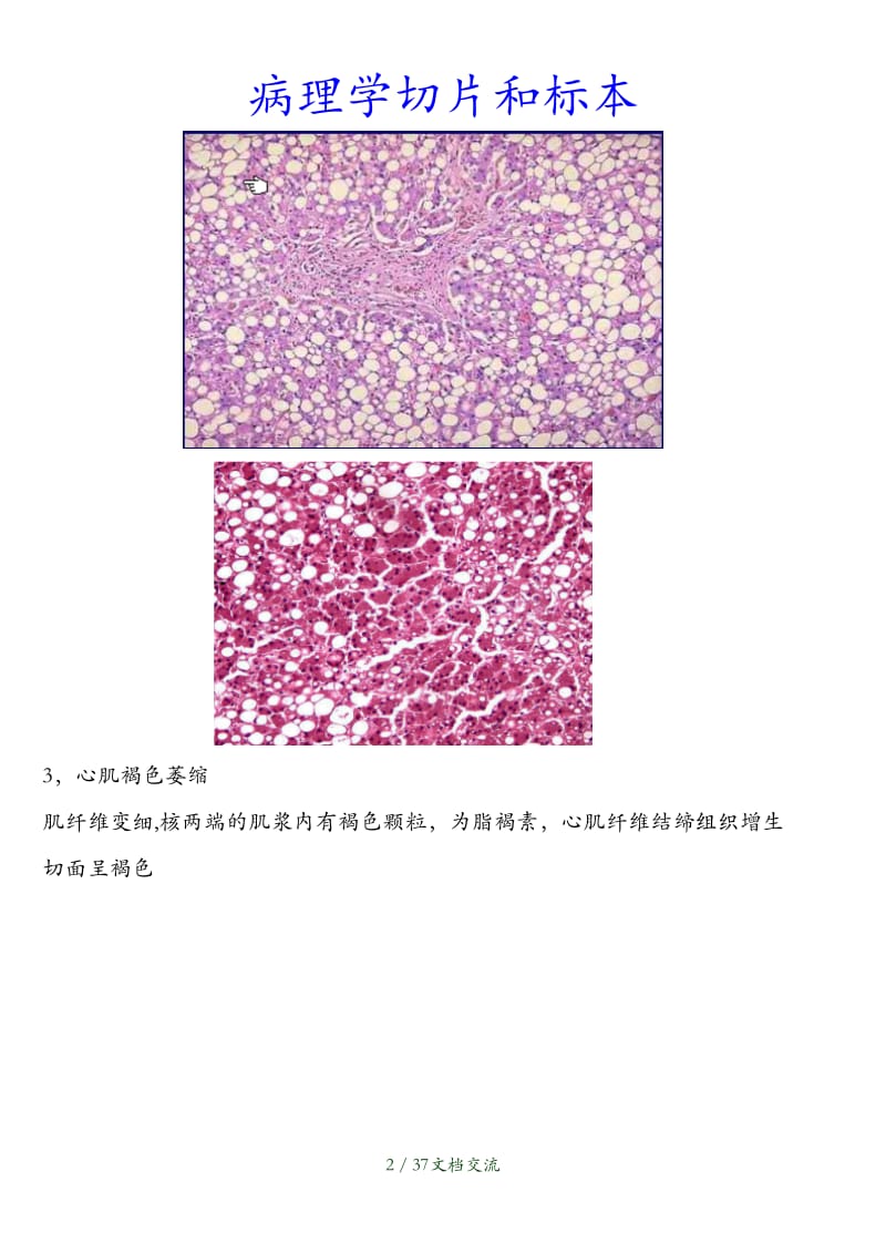 病理学切片和标本（干货分享）.doc_第2页