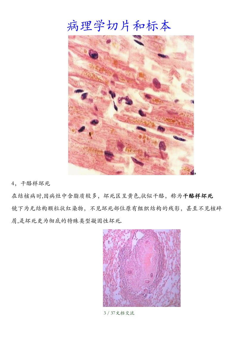 病理学切片和标本（干货分享）.doc_第3页