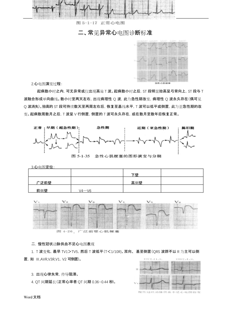 常见心电图特点及波形.docx_第2页