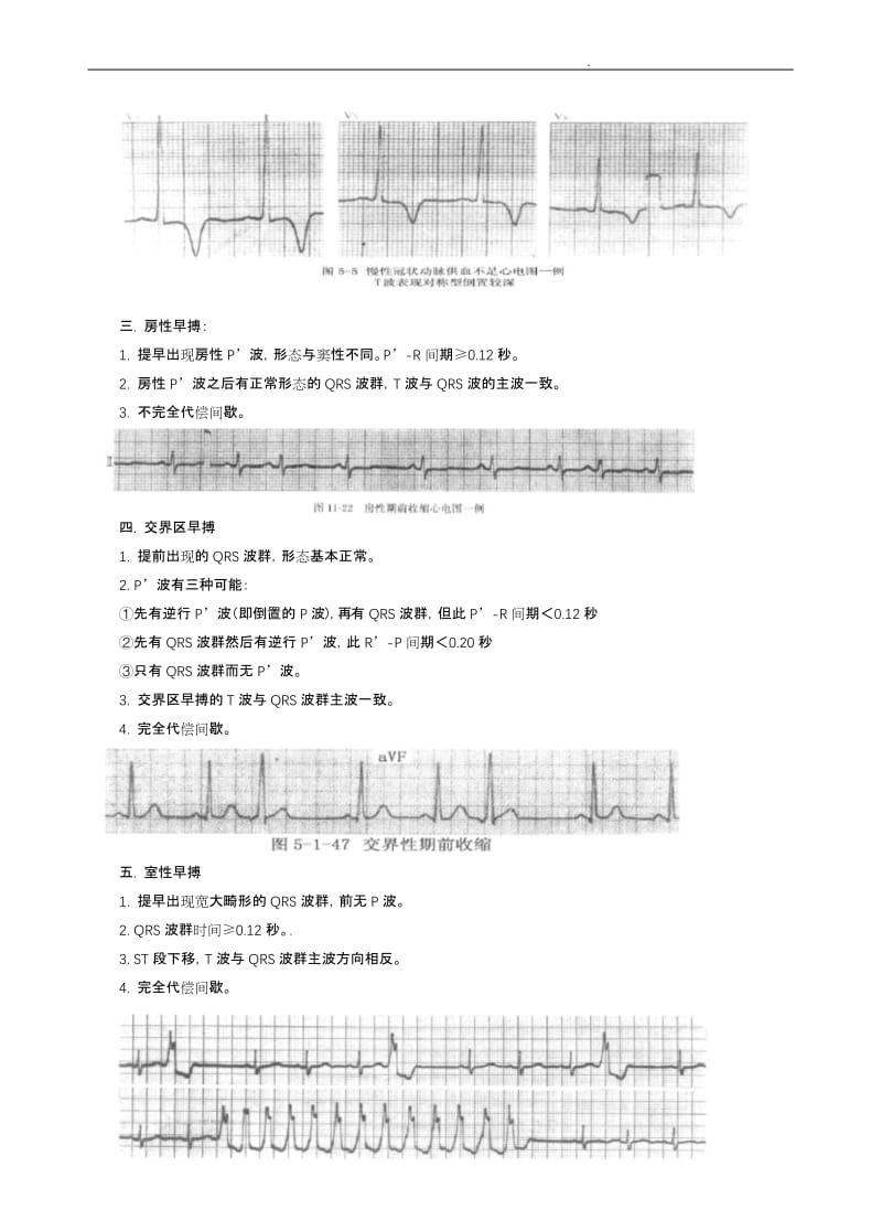 常见心电图特点及波形.docx_第3页