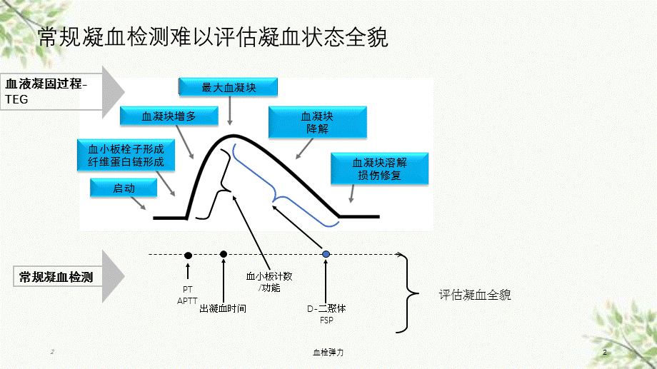 血栓弹力课件.ppt_第2页