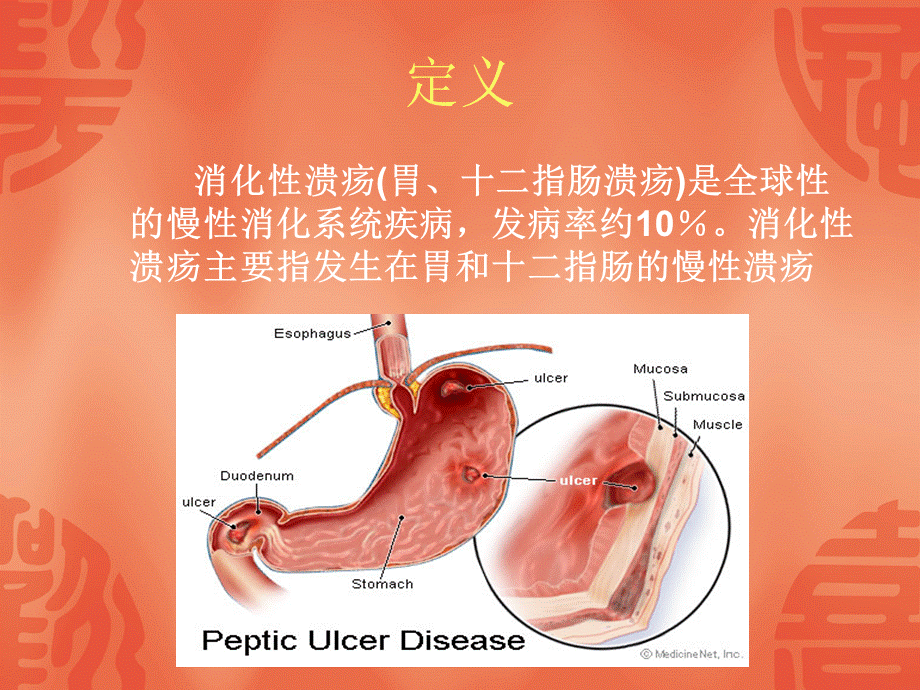 注射用奥美拉唑钠-海南中化联合.ppt_第3页