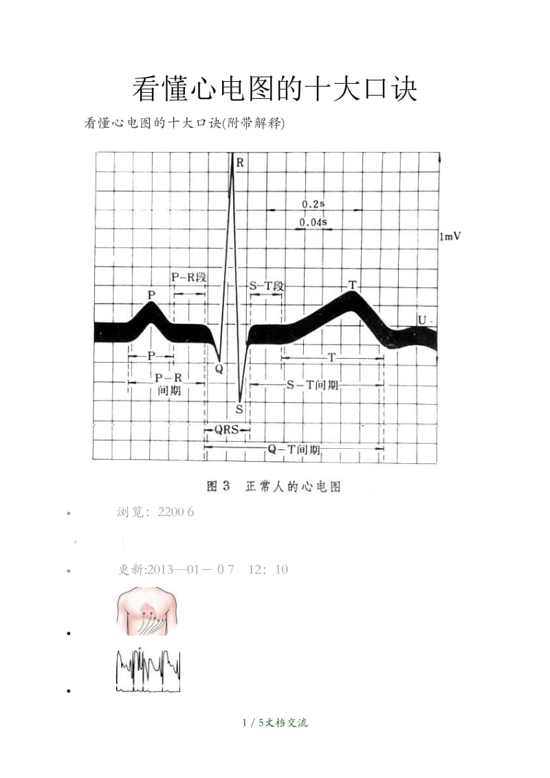 看懂心电图的十大口诀（干货分享）.docx_第1页