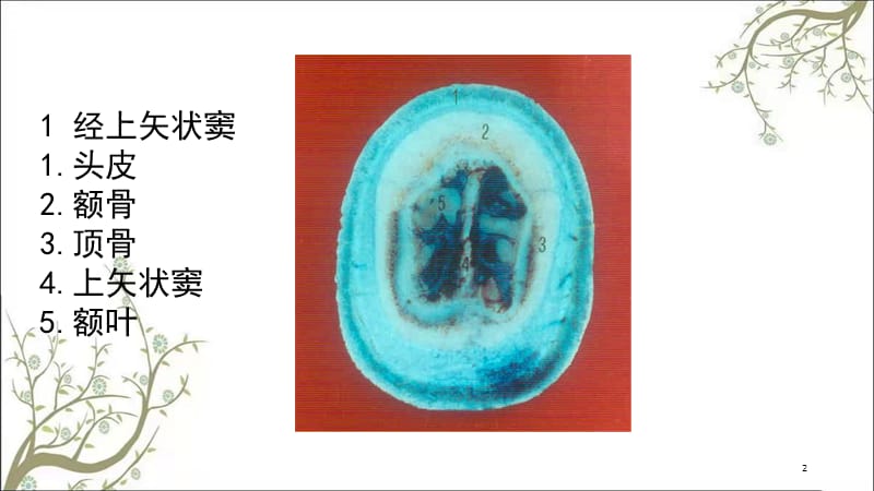 头颈部断面解剖课件.ppt_第2页