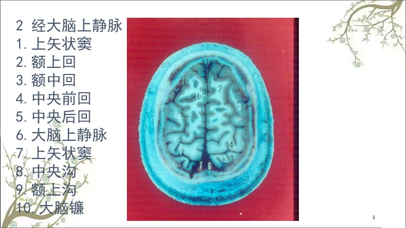 头颈部断面解剖课件.ppt_第3页