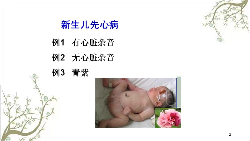 生儿先天性心脏病课件.ppt_第2页