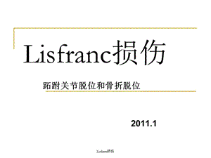 最新Lisfranc损伤.ppt