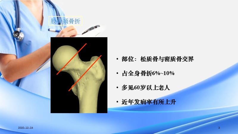 讲课股骨颈骨折（精选干货）.ppt_第3页