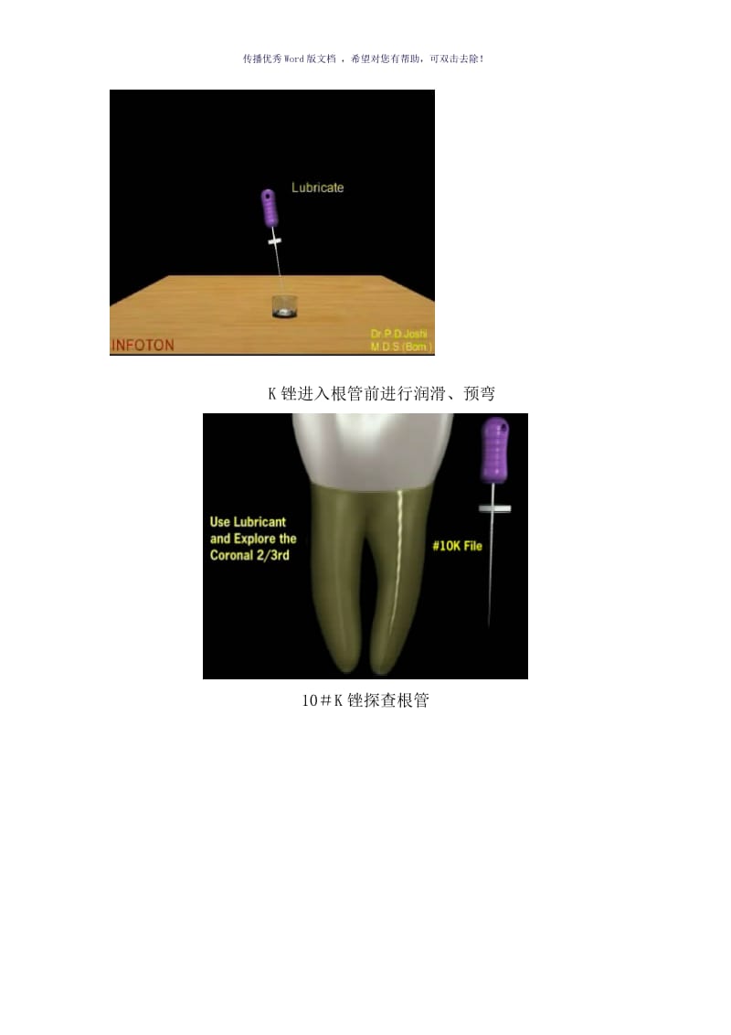 根管预备操作流程（参考模板）.doc_第3页