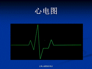 正常心电图波形特点（经典实用）.ppt