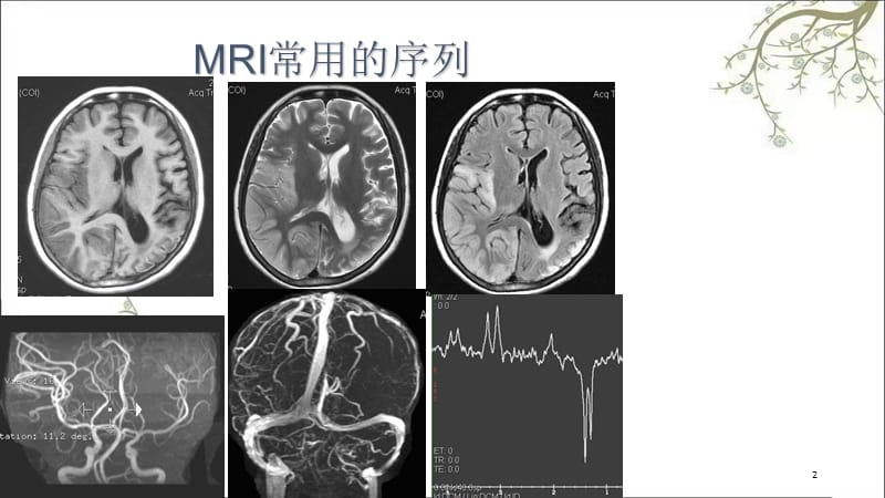 头颅MRI断层解剖课件.ppt_第2页