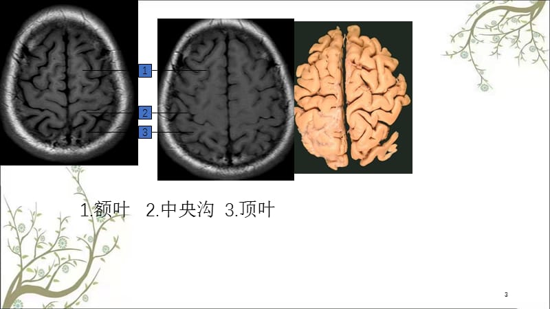 头颅MRI断层解剖课件.ppt_第3页