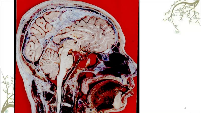 颅脑失状断层解剖课件.ppt_第2页