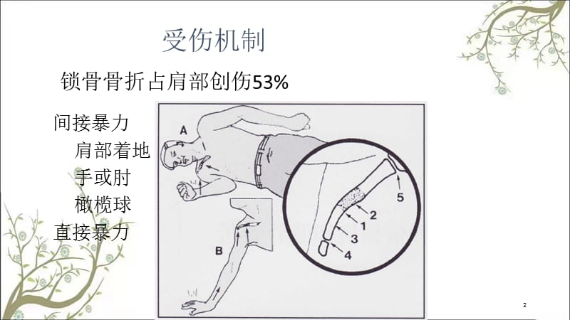 锁骨肩胛骨课件.ppt_第2页