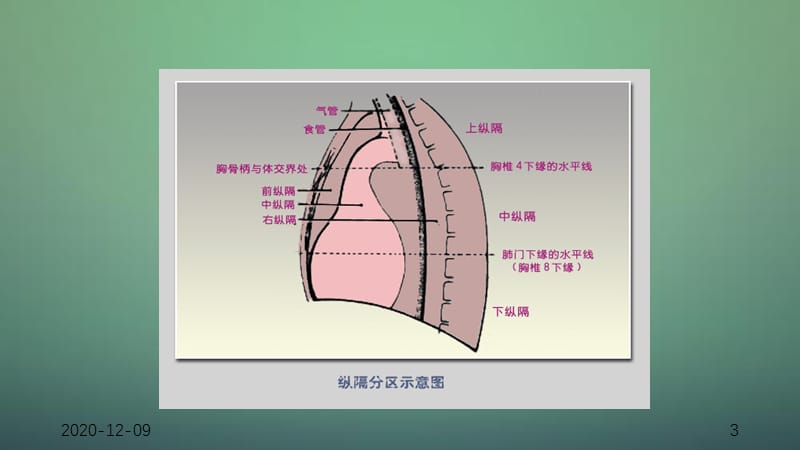 纵膈肿瘤影像诊断-（干货分享）.pptx_第3页