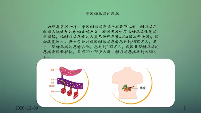 糖尿病 (2)（干货分享）.ppt_第3页