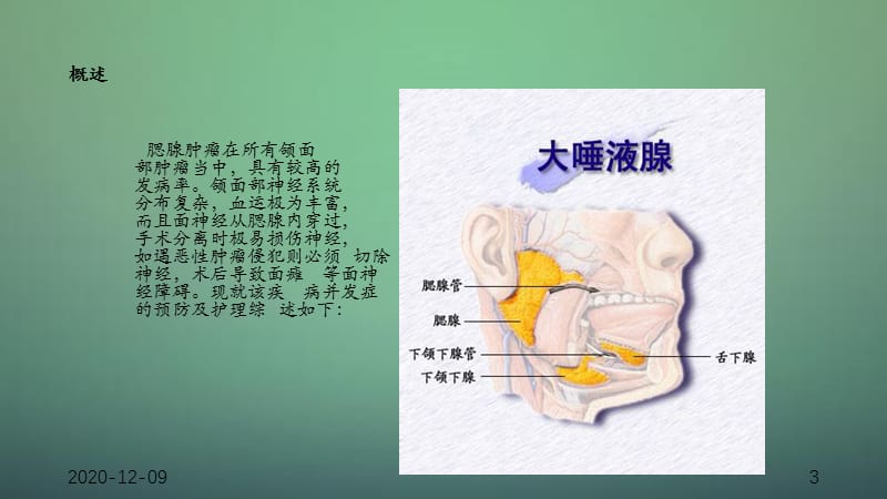 腮腺肿瘤护理-（干货分享）.ppt_第3页