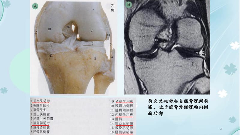 膝关节解剖及MRI诊断-（干货分享）.ppt_第3页